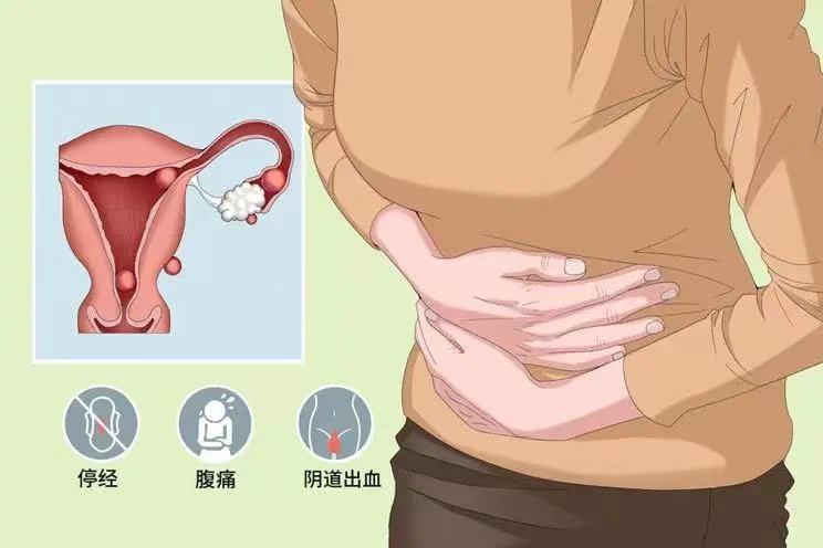 孕妇 疫情影响 隔离在小区 宫外孕破裂了......怎么办？是什么原因导致的。