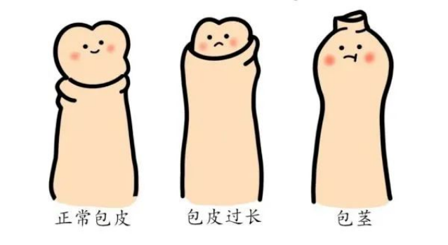 大兴安岭包皮手术后，丁丁能再度发育变大吗？