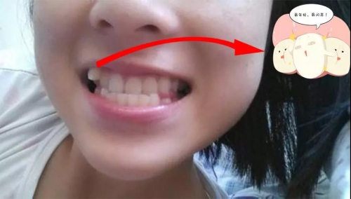 想吃点肉都塞牙，咋整？