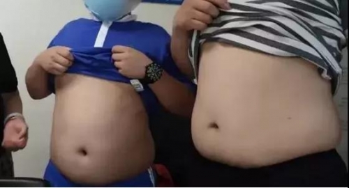 广东11岁男孩重度肝硬化！家长懵了，没想到一个很平常的“健康”习惯害了他！