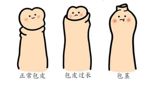 包皮手术后，丁丁能再度发育变大吗？