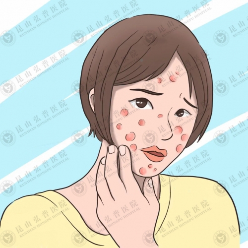 痤疮会自己好？出现这几种情况要及时就医！