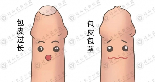 割包皮，是成年男性的自我救赎！