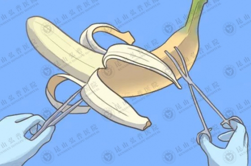 男朋友割完包皮更持久了，快感也更强烈！