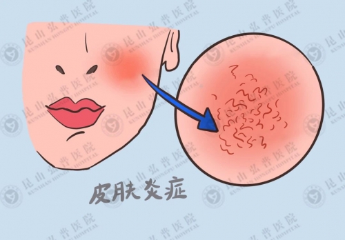 换季过敏？皮肤科医生告诉你：面对瘙痒这样做，比抓挠都管用！