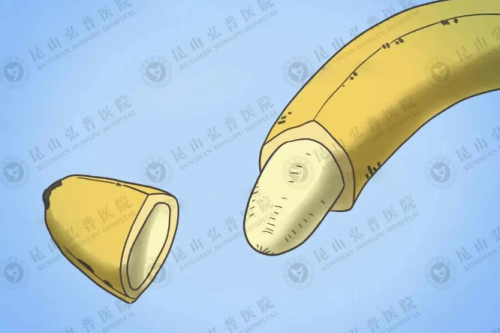 男朋友割完包皮更持久了，快感也更强烈！