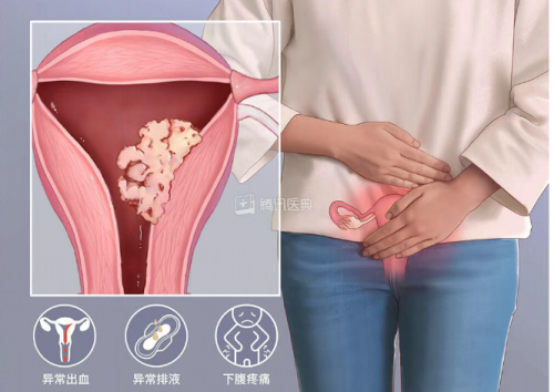 当瘙痒、疼痛、异常出血找上门，别轻视，可能是妇科预警