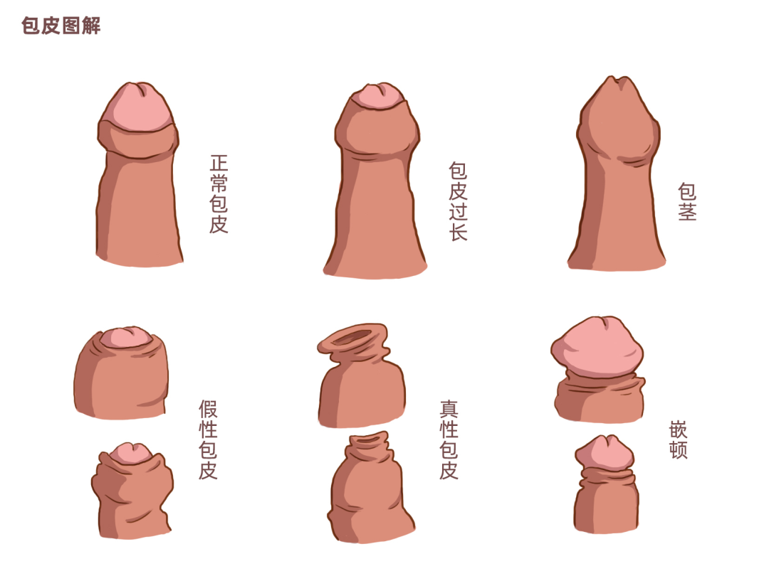 14.png