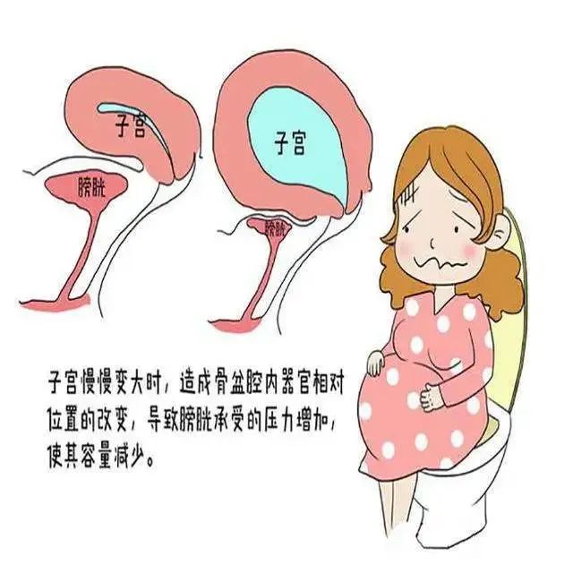 0e4b9ff8c0cebe012601f6e73ff04c45.jpg